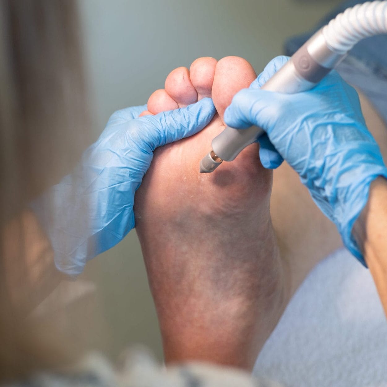 Professionelle Fusspflege bei Christina Zitz in Therwil